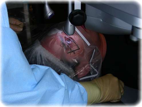 Laser mir die Augen, Kleines! Meine Lasik-Operation